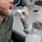 Tratamiento para la sensacion de lengua quemada