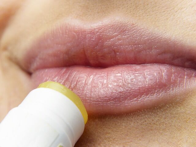 Como quitar un herpes labial en 1 día