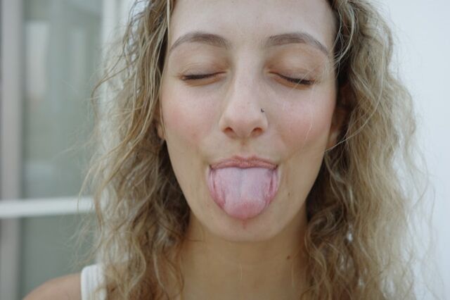 Candidiasis oral