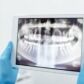 Que es una ortopantomografía dental y para que sirve