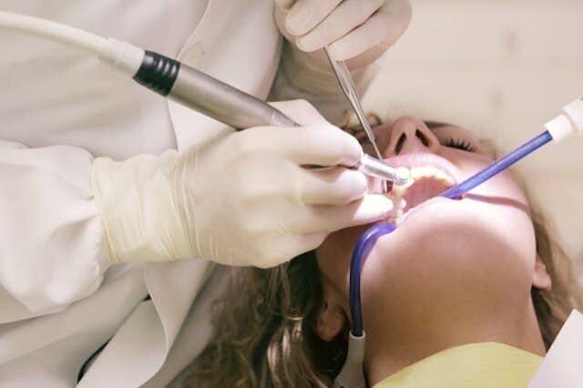 Quiste dental, qué es síntomas y tratamiento