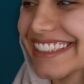 Como Blanquear los Dientes Metodos Efectivos y Recomendaciones