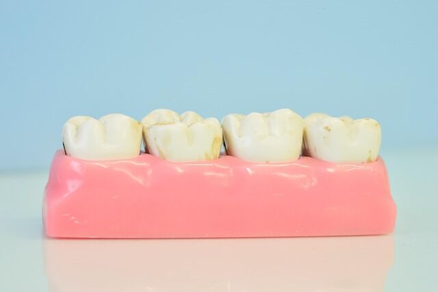 como quitar el sarro de los dientes