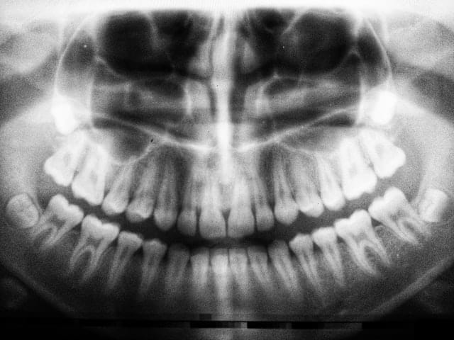 cuales son los nombres de los dientes y sus funciones