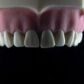 Es tu sonrisa gingival Todo lo que necesitas saber para corregirla