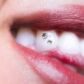Blanqueamiento Dental Todo lo que Necesitas Saber