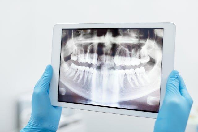 Que es una ortopantomografía dental y para que sirve