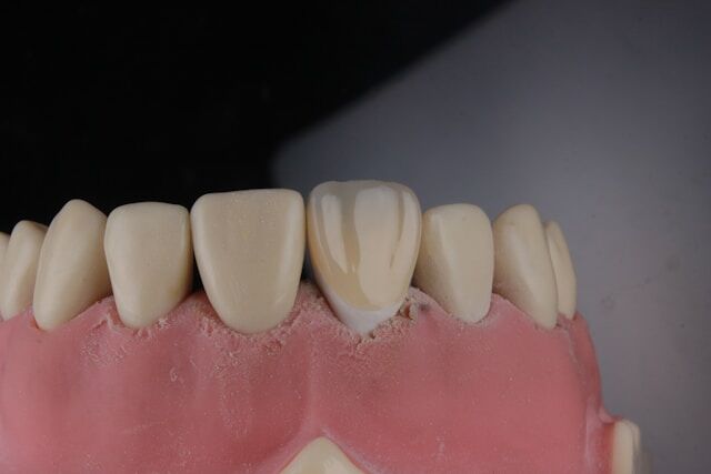 sensibilidad dental