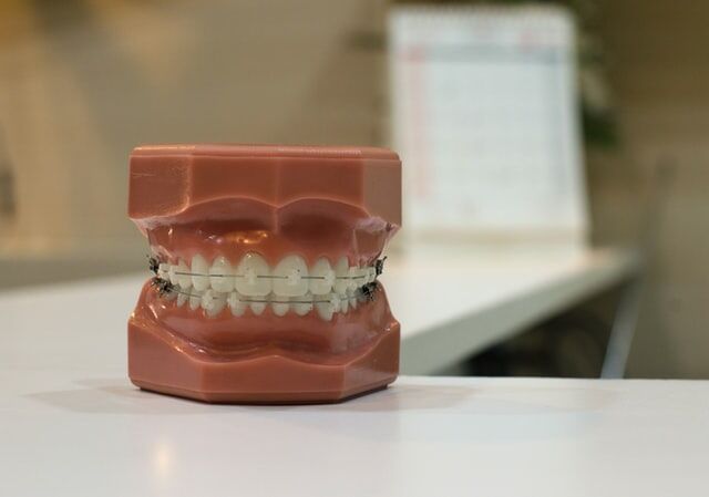 brackets de ceramica