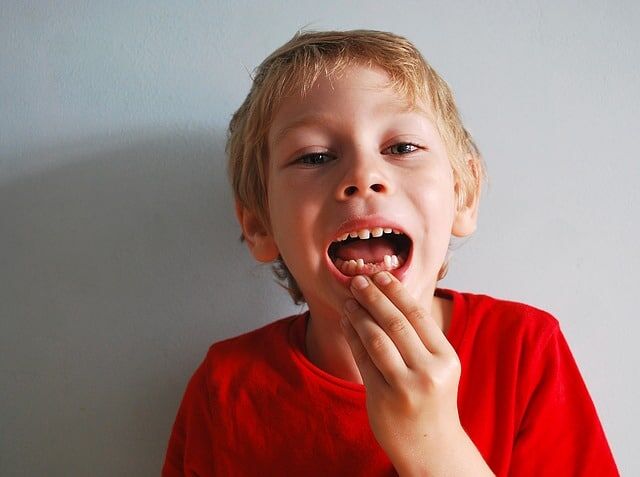 cuando se caen los dientes de leche en los niños