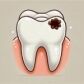 Que son las caries