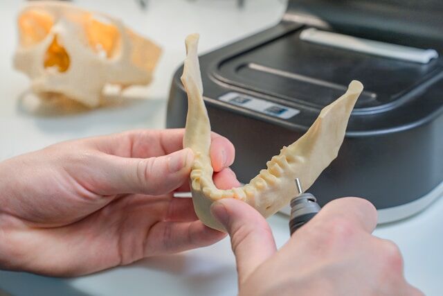 Implantes dentales subperiósticos