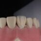 sensibilidad dental