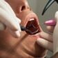 Qué hace un higienista dental
