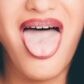 enfermedades más comunes de la lengua y su tratamiento