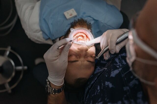 como es el mantenimiento de las carillas dentales