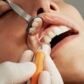 Enfermedad periodontal sintomas, tratamientos y como prevenirla