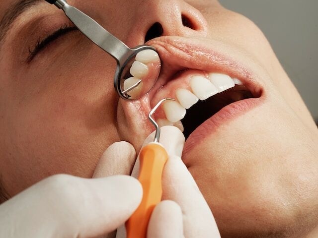 Enfermedad periodontal sintomas, tratamientos y como prevenirla